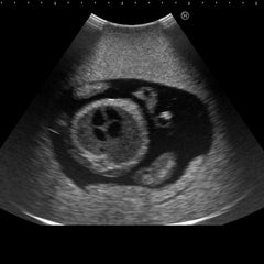 fetus ultrasound exam manikin model