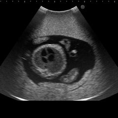 fetus ultrasound exam manikin model