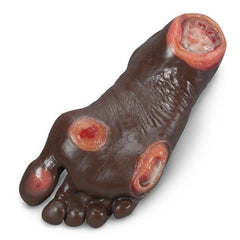 diabetic foot wound sore model