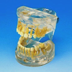 primary dentition model