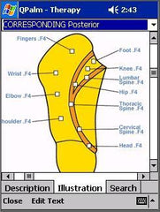 QPalm  Auricular Therapy Software For Pulm Or For Pocket PC