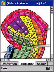 QPalm  Auricular Therapy Software For Pulm Or For Pocket PC