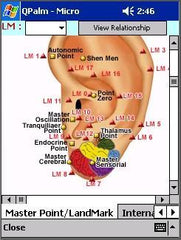 QPalm  Auricular Therapy Software For Pulm Or For Pocket PC