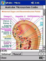 QPalm  Auricular Therapy Software For Pulm Or For Pocket PC