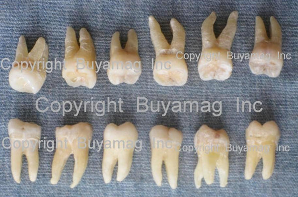 Real Tooth
