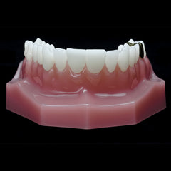 restoration dental model