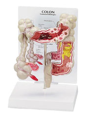 Colon Model Deluxe