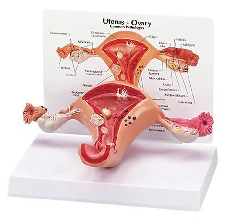 Uterus And Ovaries Deluxe