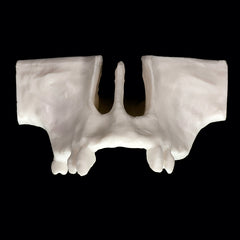 sinus lift model