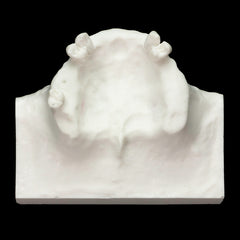 dental sinus lift model