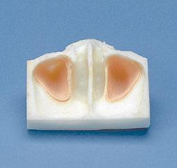 Sinus Lift Maxillary Model