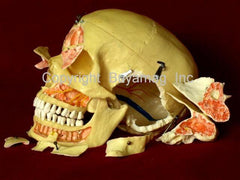skull anatomical models