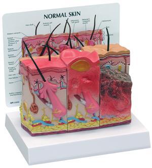 Skin Burn & Normal Model