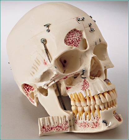 Dental Skull Model With Display Case Deluxe Academy