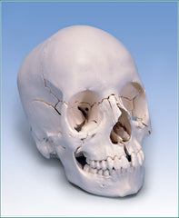 skull anatomical model A290