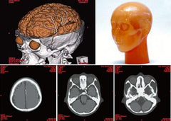 skul x-ray simulator manikin