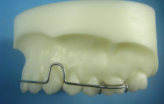 Adams Clasps Retainer Orthodontic Model