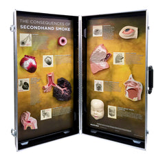 secondhand smoking model display