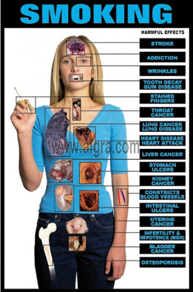 Smoking Health Effects Poster Chart