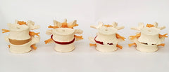 Spine Lumbar 4 Stages Disk Degeneration Models