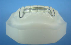 Modified Spring Retainer Orthodontic Model +2