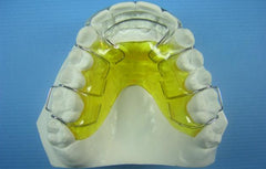 Modified Spring Retainer Orthodontic Model