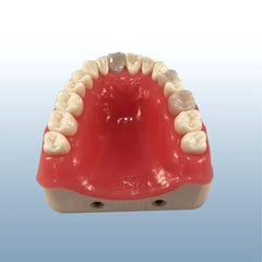 Dental Endodontic Surgical Model