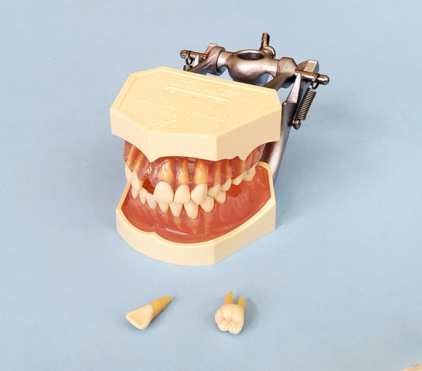 tooth extraction typodont