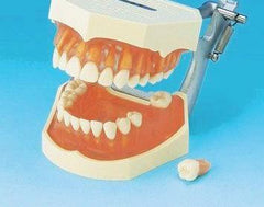 teeth extraction model