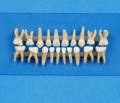 Three Root Molar With Dental Caries 6 Part, Giant Model