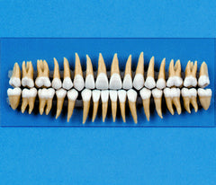 dental teeth replacement