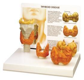 Thyroid Model Set Of 4 part
