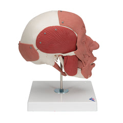 tmj temporomandibular disorder skull model 
