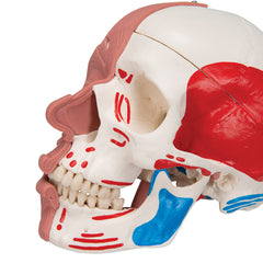 tmj dysfunction skull model 