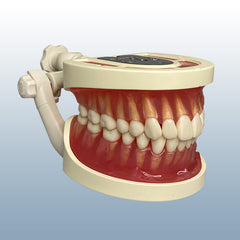 tooth extraction dental model