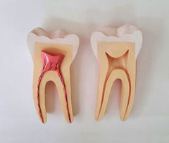 human molar teeth models