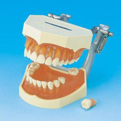 Replacement  Teeth