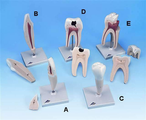 Deluxe Giant Teeth Models