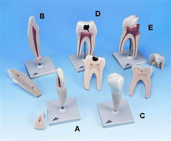 Lower Incisor 2 Part (A)
