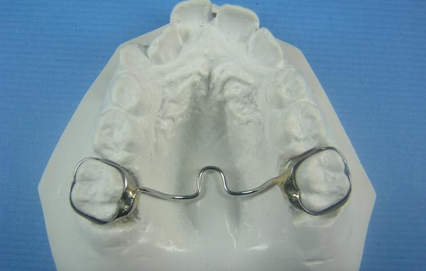 Transpalatal Arch Retainer Orthodontic Model
