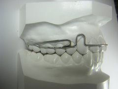 Tremont Cantilever Wrap Around Retainer Orthodontic Model
