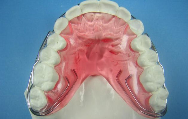 Tremont Cantilever Wrap Around Retainer Orthodontic Model