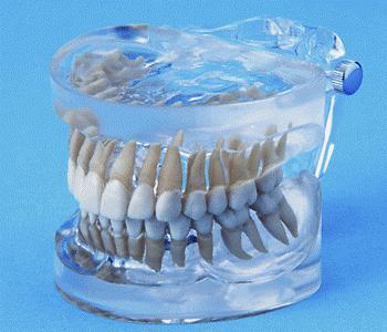 Dental model upper & lower arches
