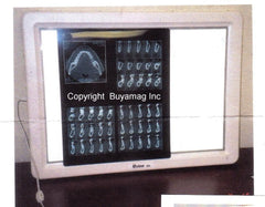 dental light box film viewer