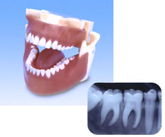 Dental X-Ray Radio-opaque Adult Portable Self-Contain System Simulator - Manikin Training Complete