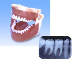dental x-ray practice model 